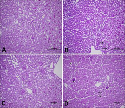 Nose-Only Water-Pipe Smoke Exposure in Mice Elicits Renal Histopathological Alterations, Inflammation, Oxidative Stress, DNA Damage, and Apoptosis